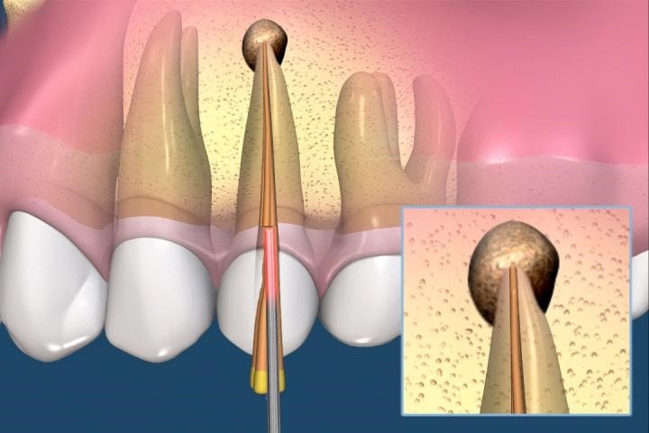 Cotroceni Dental - clinica stomatologica