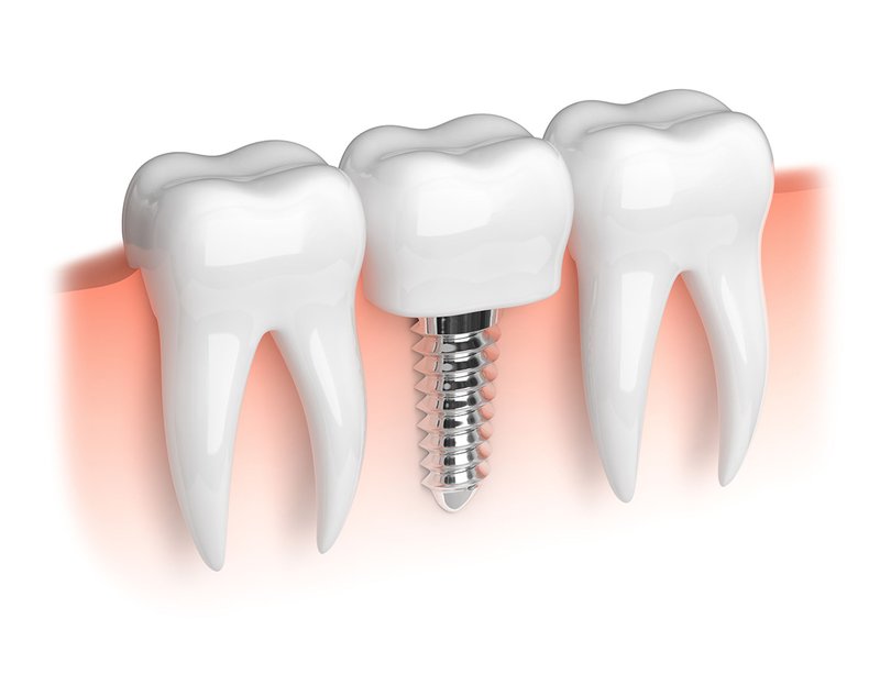 Cotroceni Dental - clinica stomatologica